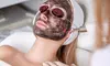 One or Two Carbon Laser Peel Treatments with Mask for Radiant Skin at SkinVital Studio Up To  69% Off
