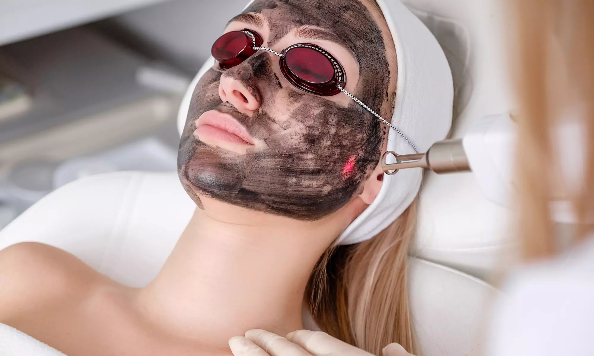 One or Two Carbon Laser Peel Treatments with Mask for Radiant Skin at SkinVital Studio Up To  69% Off - Primary Image