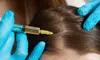 Transform with One, Two or Three PRP Injection Tubes at Duke Medical Clinic-Spa Carrera 鑫国际医美 (Up to 70% Off)