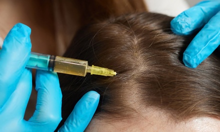 One Tube of PRP Injections for Hair Restoration - Duke Medical Clinic-Spa Carrera 鑫国际医美