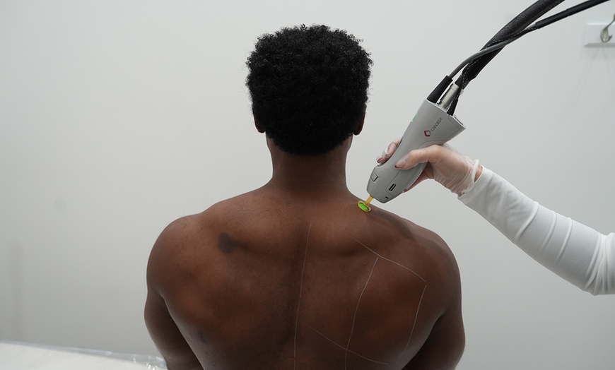 Image 26: Smooth, Hair-Free Skin with Laser Hair Removal at Semper Laser