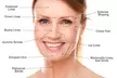 Revitalize Your Skin with Dysport, Botox, and Juvéderm at Restorative Health Center (Up to 54% Off) - Second Medium