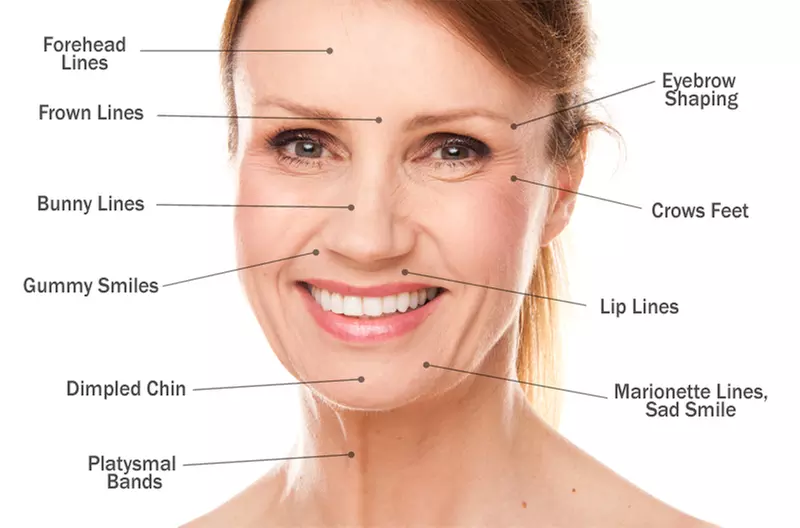 Revitalize Your Skin with 30 or 60 Units of Dysport