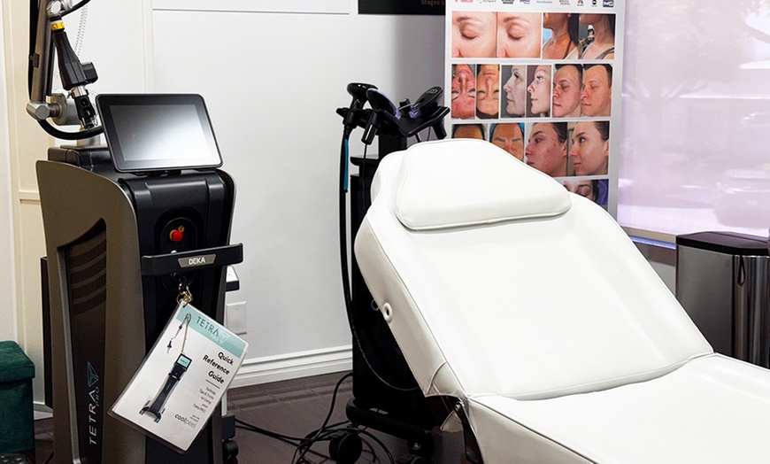 Image 3: Brighten Dull Skin with One or Two Custom Chemical Peels