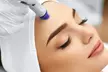 Rejuran Skin Booster Microneedling & LED Therapy Sessions at Castillo Aesthetics for Skin Repair (Up To 64% Off) - Image 2