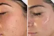 Revitaliza tu rostro con una limpieza facial profunda con 9 pasos para 1 persona con un 55% de descuento - Image 3