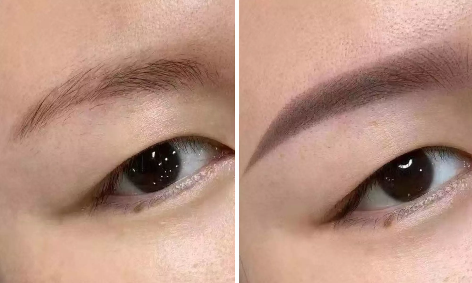 45 Min. Carbon Laser Peeling oder IPL Behandlung nach Wahl für 1 Pers.