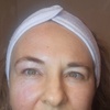 Image 2: Ultrasonic Cavitation and HIFU for Various Body Areas