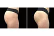 Up to 56% Off on Electrical Muscle Stimulation at TS3 Hair Salon And Spa - Second Medium