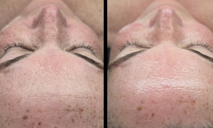 Image 4: Cica Rescue- Korean/ Radiant Cascade Facials, Sea Sponge Peels+ Facial