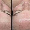 Image 4: Cica Rescue- Korean/ Radiant Cascade Facials, Sea Sponge Peels+ Facial