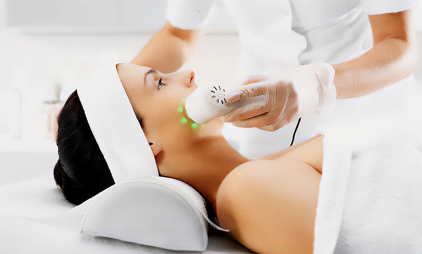 Image 6: Limpieza facial en 7 pasos con tratamientos a elegir para 1 persona 