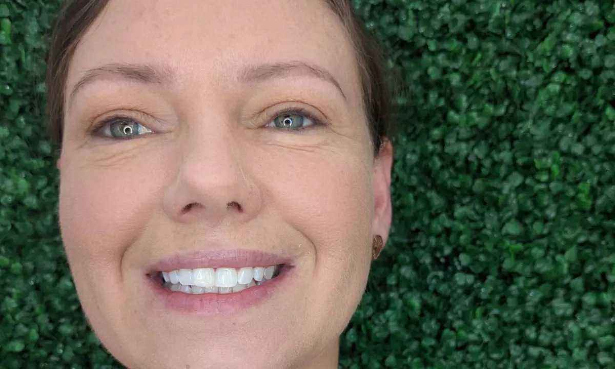 Premium 60-Minute Teeth Whitening at Smile Labs Penrith