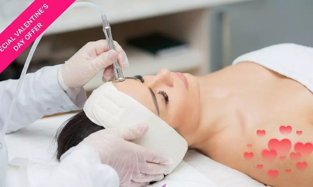 Valentine's Day Special: Diamond-Microdermabrasion Treatment; Valid Wednesdays Only at GC Skin and Medspa (Up to 50% Off) - Primary Image