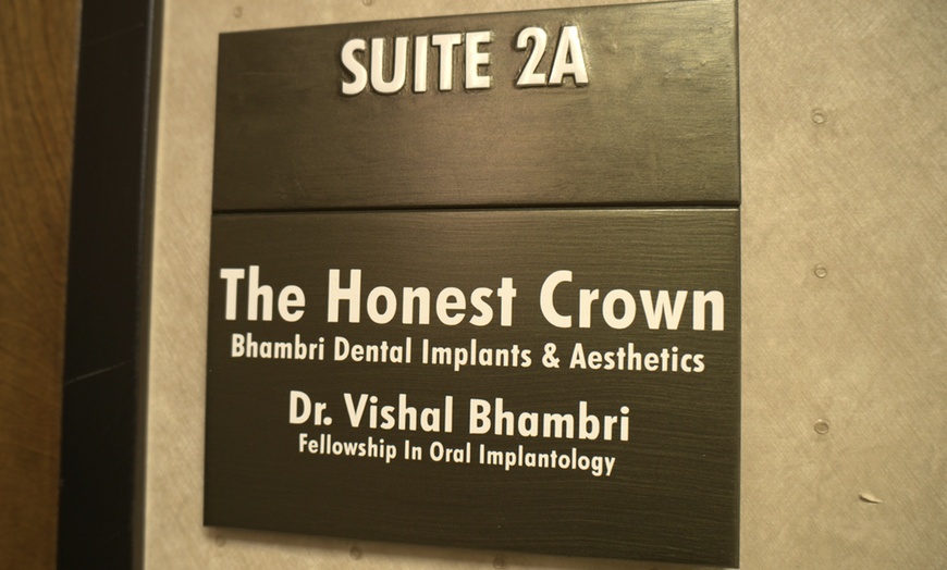 Image 6: Dental Implants
