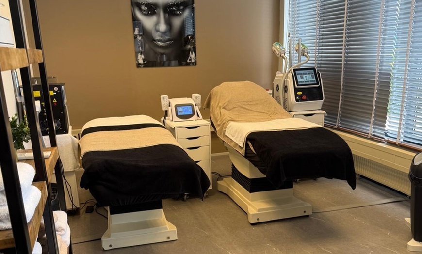 Image 1: Bereik je droomlichaam met cryolipolyse en lipolaser pads