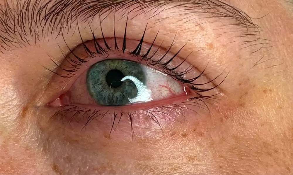 Eyelash Lift or Eyelash Tinting & Lift Treatment for Beautiful Lashes at Aunist Beauty(Up To 55% Off)