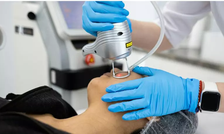 Get a Three Laser Hair Removal Sessions on Small, Medium or Large Area