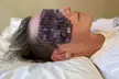 Get Glowing: Violet Wellness Spa by Tian Chao Herbs & Acupuncture's Non-Surgical Facelift Package(Up to 30% Off) - Second Medium