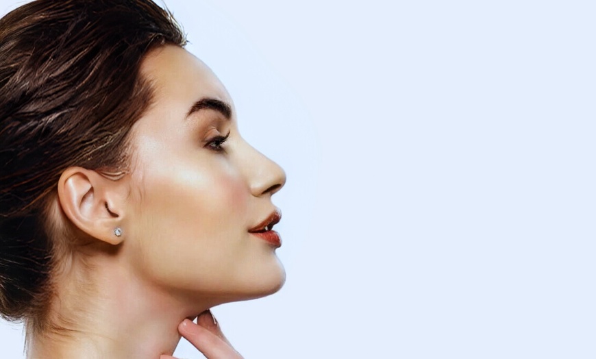 Image 1: Up to 40% Off on Microneedling at Skin Hub Med Spa And Salon