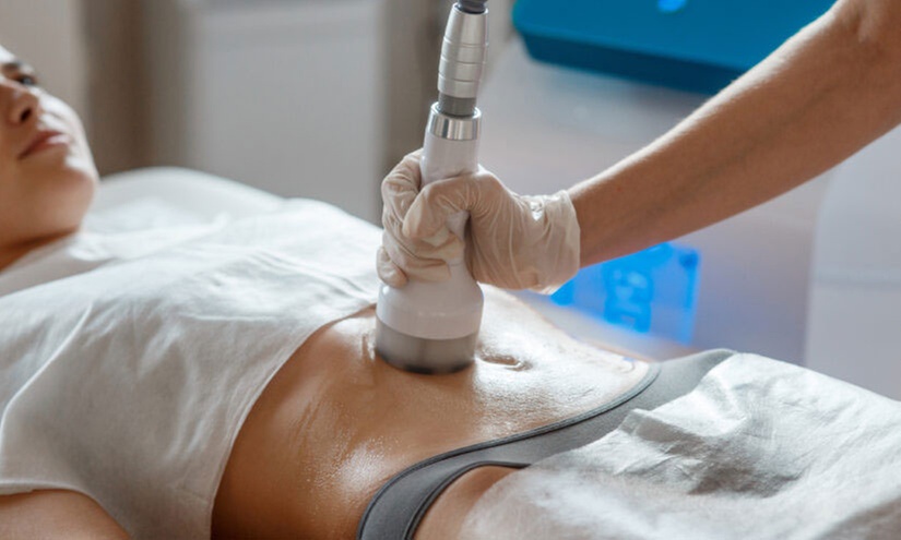 Up to 54% Off on Cryolipolysis Permanent Fat Reduction