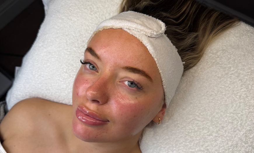 Image 2: Refresh Your Skin with Dermaplaning and Chemical Peel