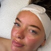 Image 2: Refresh Your Skin with Dermaplaning and Chemical Peel