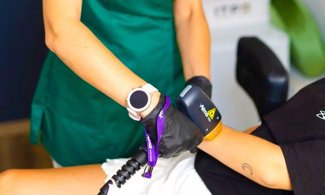 Depilacja laserowa Soprano Ice Platinum na wybraną partię ciała