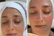Hydrafacial Glow & Lashlifting bij Beauty Clinic by Nouha - Image 4
