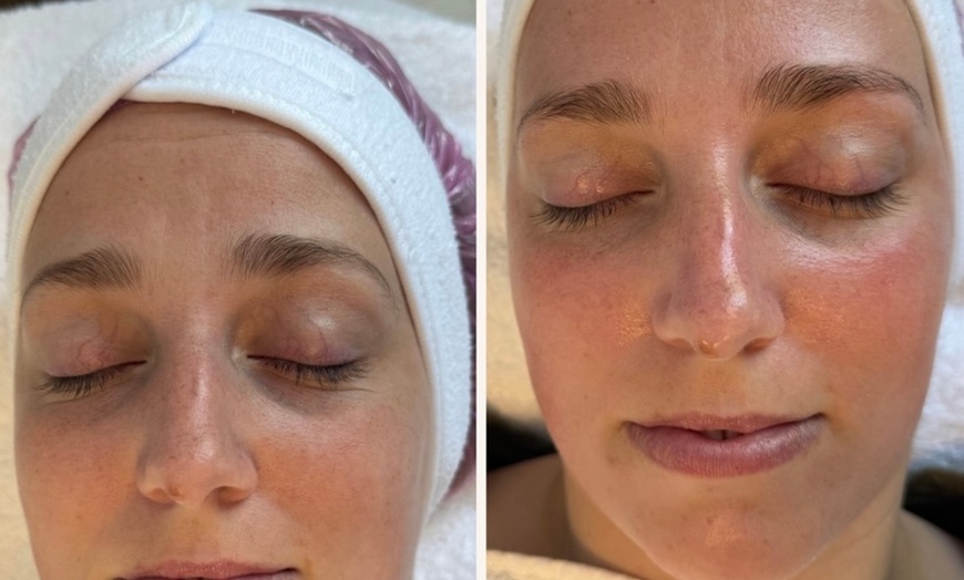 Image 4: Hydrafacial Glow & Lashlifting bij Beauty Clinic by Nouha