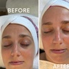 Image 4: Hydrafacial Glow & Lashlifting bij Beauty Clinic by Nouha