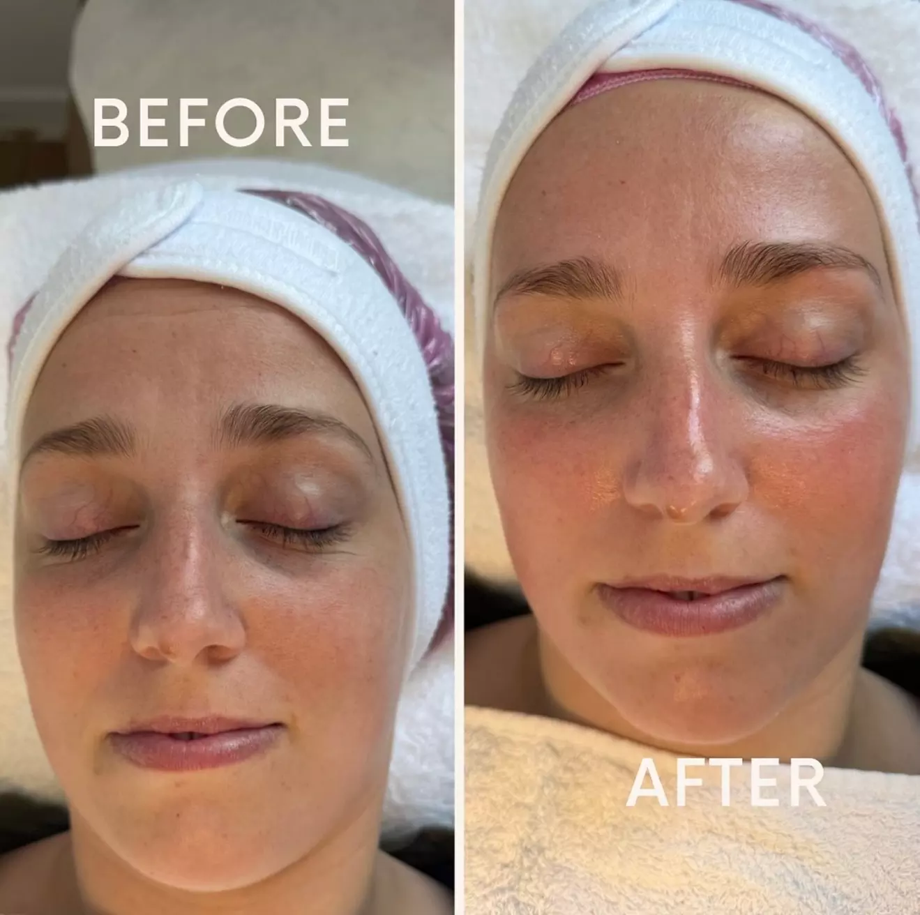 Hydrafacial Glow & Lashlifting bij Beauty Clinic by Nouha