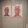 Image 2: Rejuvenate your look with Advanced Xeomin Treatments