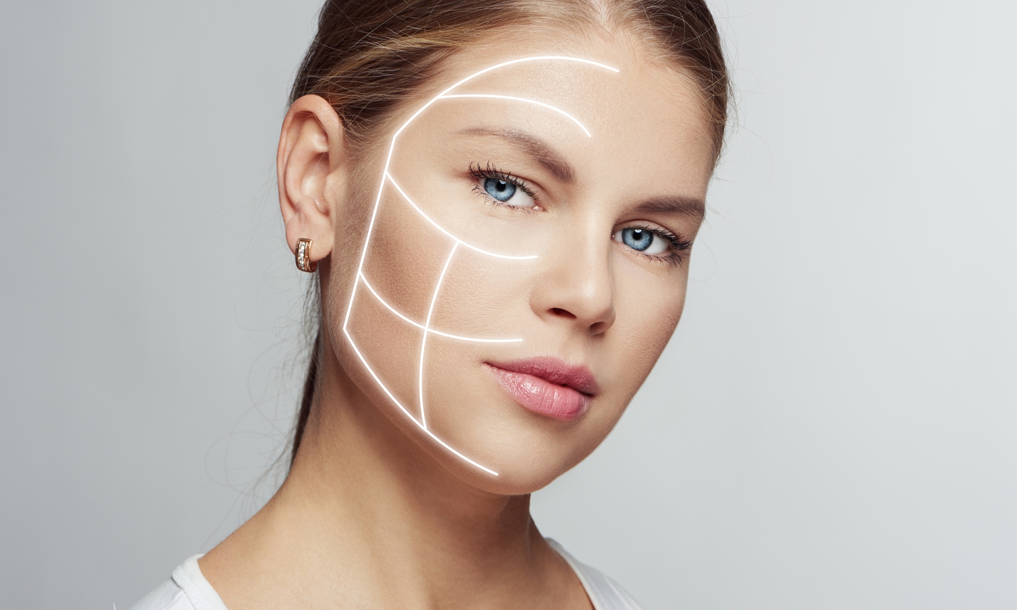 Needle Shaping: lifting bez skalpela na twarz, szyję i dekolt