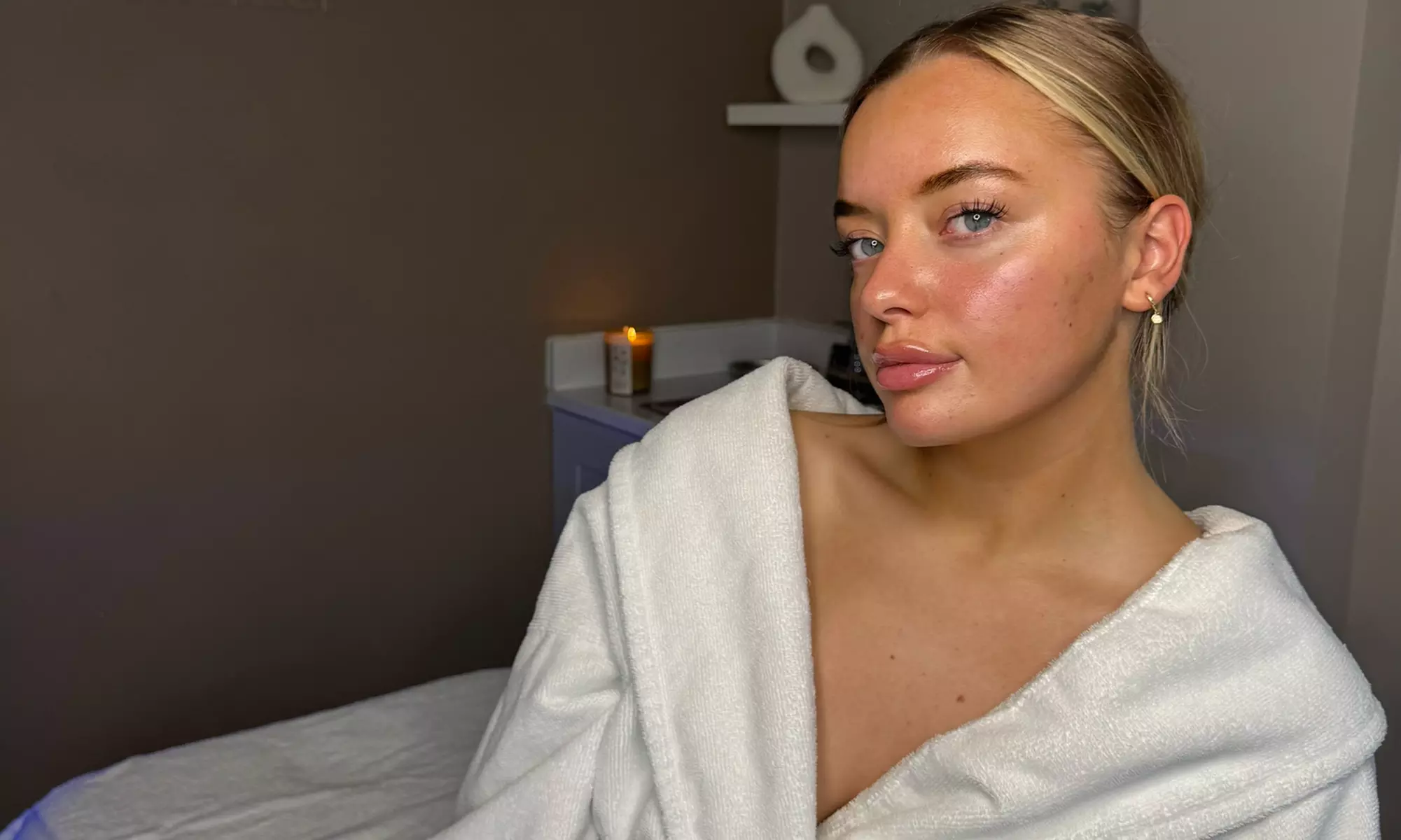 Cheshire Treatment Lounge Offers Dermaplaning with a Chemical Peel, Revealing Radiance at up to 84% Off - Primary Image