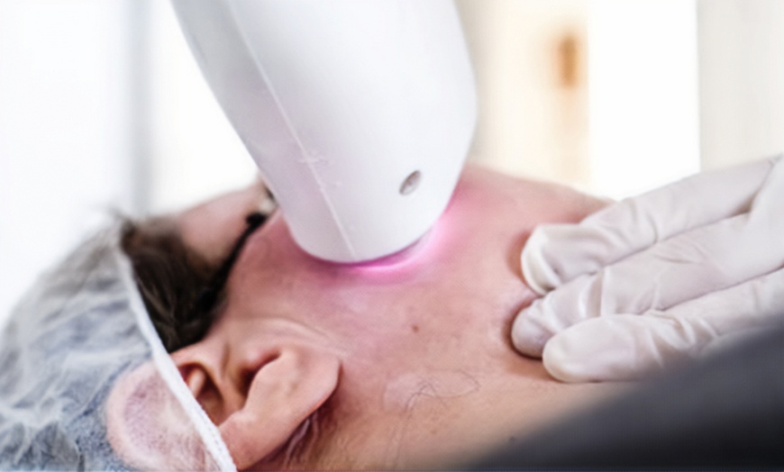 Image 8: Depilación con láser de diodo en zona a elegir para 1 persona