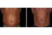 Up to 56% Off on Electrical Muscle Stimulation at TS3 Hair Salon And Spa - Second Medium