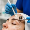 Image 2: 1, 2, or 3 Sessions of Chemical Peel & Skin Needling Or Facial & More