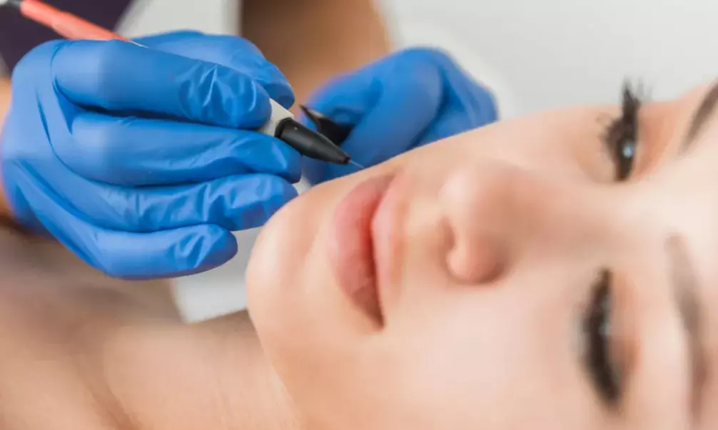 3 or 6 Laser Hair Removal Sessions on a Small, Medium, or Large Area