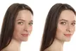 Glow Your Skin with One, Three or Five 60 Min Chemical Peel Facials at The Skin Studio (Up to 70%Off) - Second Medium