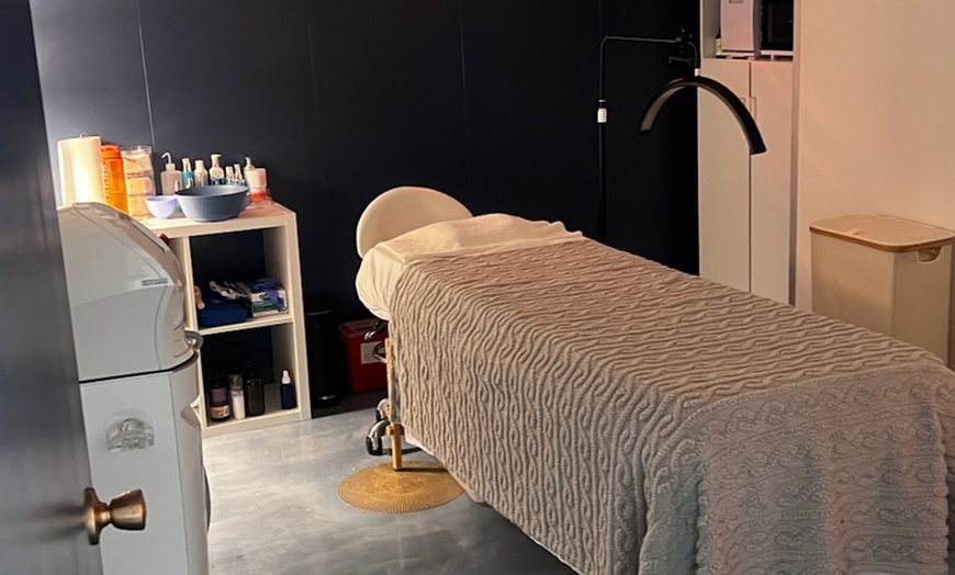 Image 7: 1, 3 or 6 Sessions of Radiofrequency Microneedling Full Face and More