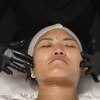 Image 1: Your Skin Revival Starts Here w/ 1 or 2 Hydradermabrasion Treatments  