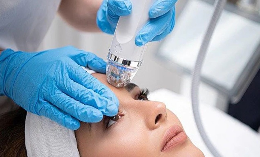 Image 6: Radio Frequency or Dermapen Skin Needling on Face & Neck or More