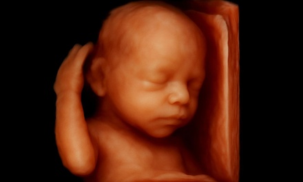 Ecografía 4D-5D emocional básica - Mi Maternidad