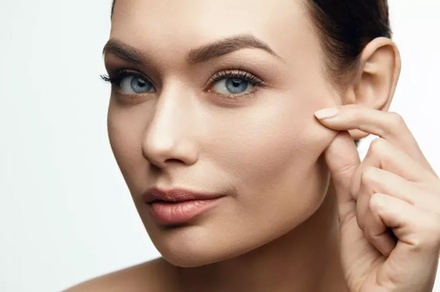 Two PDO Thread Lifts for Mid-Face Area with One Barbed Thread/Side - Perfect Med Spa Long Island