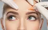 Rejuvenate Your Look with Botox, Juvederm Ultra, or a Lip-Flip at Uaesthetics and Wellness Institute (Up to 56% Off)