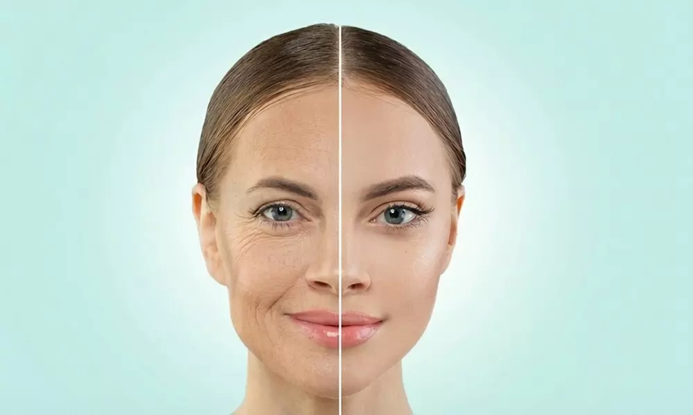 Endermologie Sessions for Full Face and Decollete