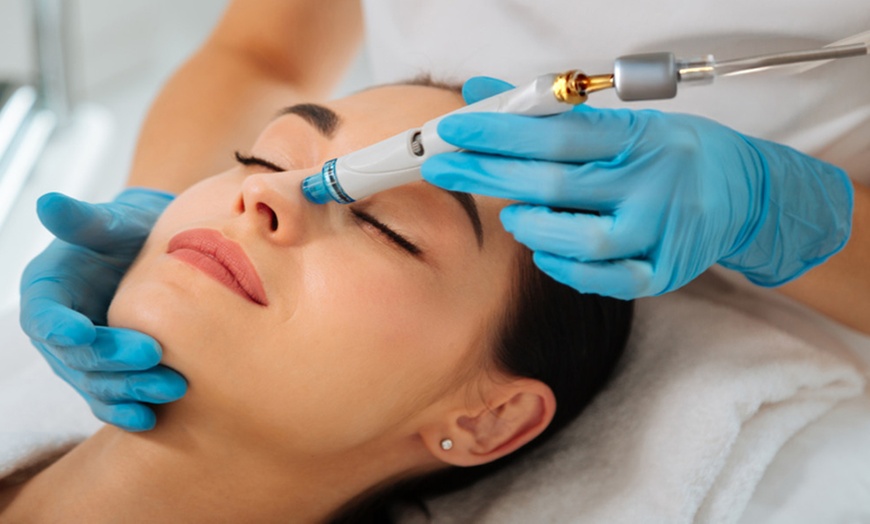 Image 1: Refresh your skin with a Signature Hydrafacial at SkinSpaceUK