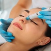 Image 1: Refresh your skin with a Signature Hydrafacial at SkinSpaceUK