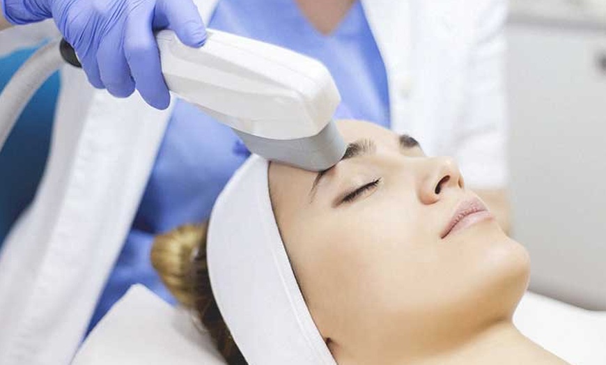 Image 4: Revitalize with One, Two or Three 60 Min IPL Skin Facial Rejuvenation